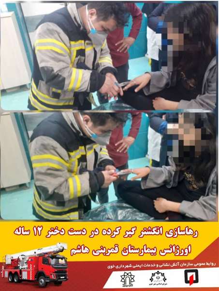 رهاسازی انگشتر گیر کرده در دست دختر ۱۲ ساله در اورژانس بیمارستان قمربنی هاشم 